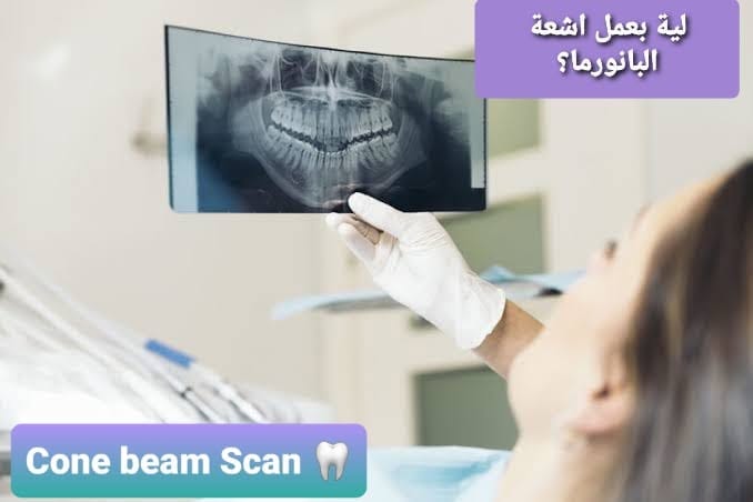 لماذا تعتبر أشعة بانوراما الأسنان خطوة أساسية قبل العلاج؟