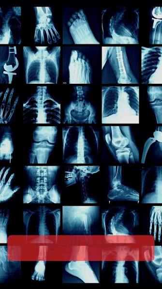 اشعة عاديه علي اجزاء الجسم X-ray